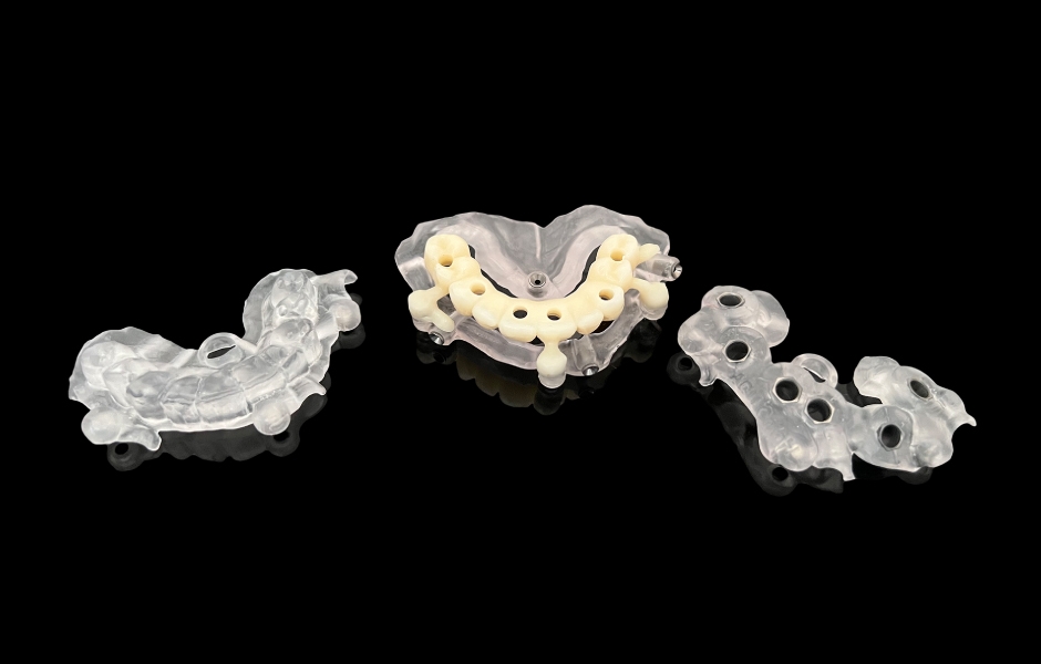 Obr. 8: Návrh a výroba modulární chirurgické šablony s okluzálně-palatinálními vstupy pro šrouby.