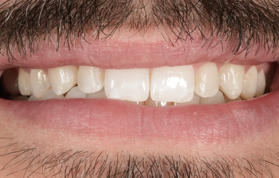 Obr. 6a: Předoperační pohled na úsměv.