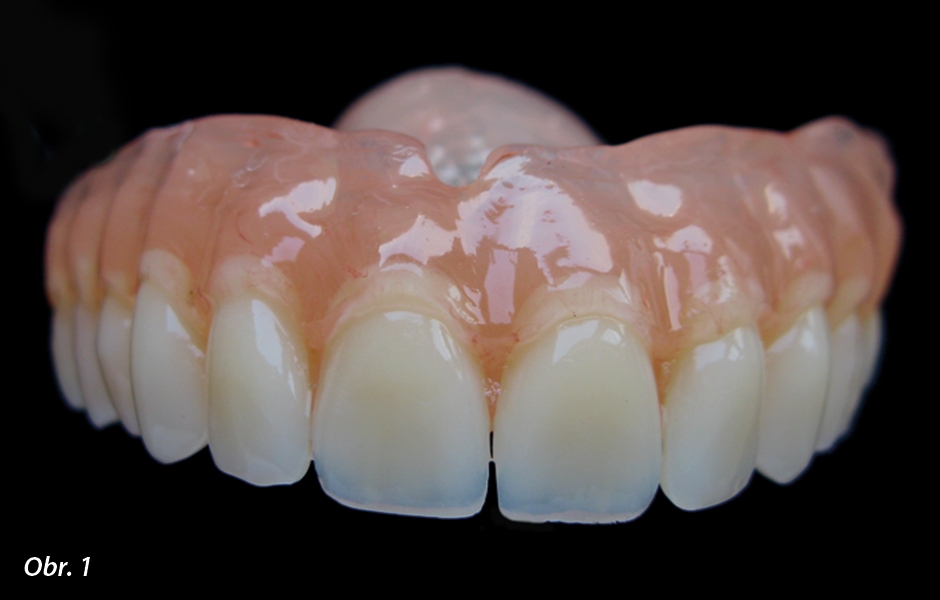 Protéza zhotovená standardně, s optimálně anatomicky postavenými zuby, které mají ideální souměrný tvar (Deflex Classic)