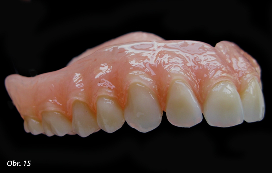 Detaily úprav incizních hran zubů, včetně pohledu na mezery mezi zuby