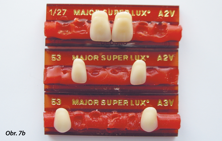 Obr. 7a–c: Výběr a individualizace konfekčních zubů Major Super Lux.