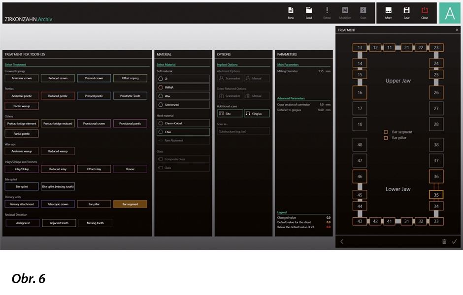 V archivu softwaru byla vytvořena speciální složka pro design suprakonstrukcí.