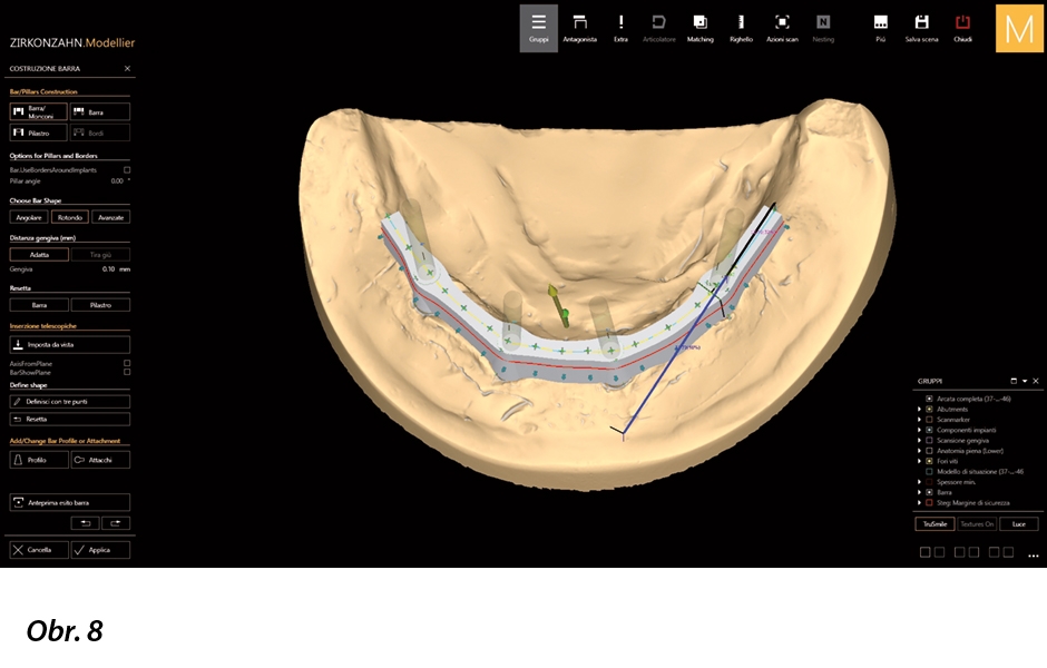 Pomocí pokročilých možností zobrazuje software Zirkonzahn.Modellier různé body a linie na suprakonstrukcích a umožňuje posun primární struktury do různých pozic.