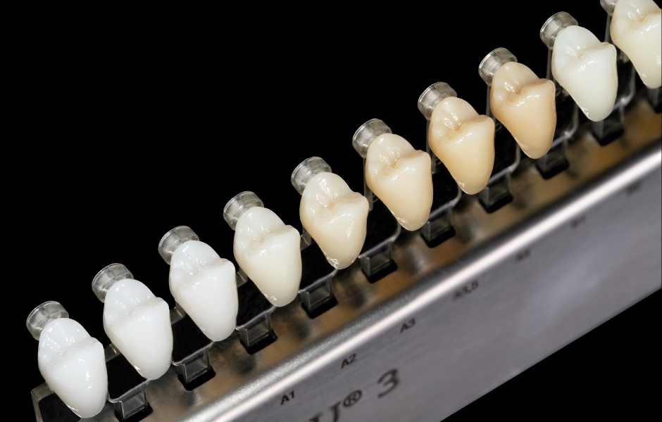 Obr. 17a–d: Vzorník Zirkonzahn Shade Guide Prettau® Line se skládá ze vzorových zubů ve tvaru horních a dolních řezáků a premolárů vyrobených z monolitického zirkonu, čímž je zajištěn přesný výběr barvy definitivní náhrady.