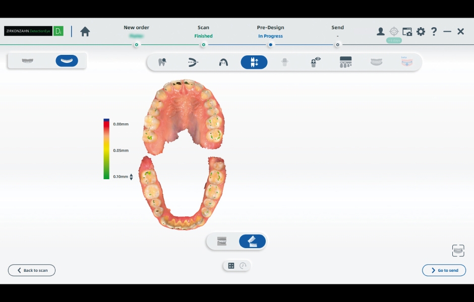 Obr. 3a, b: Zobrazení a ověření finálních skenů; ověření a korekce okluze ve specializovaném softwaru Detection Eye.