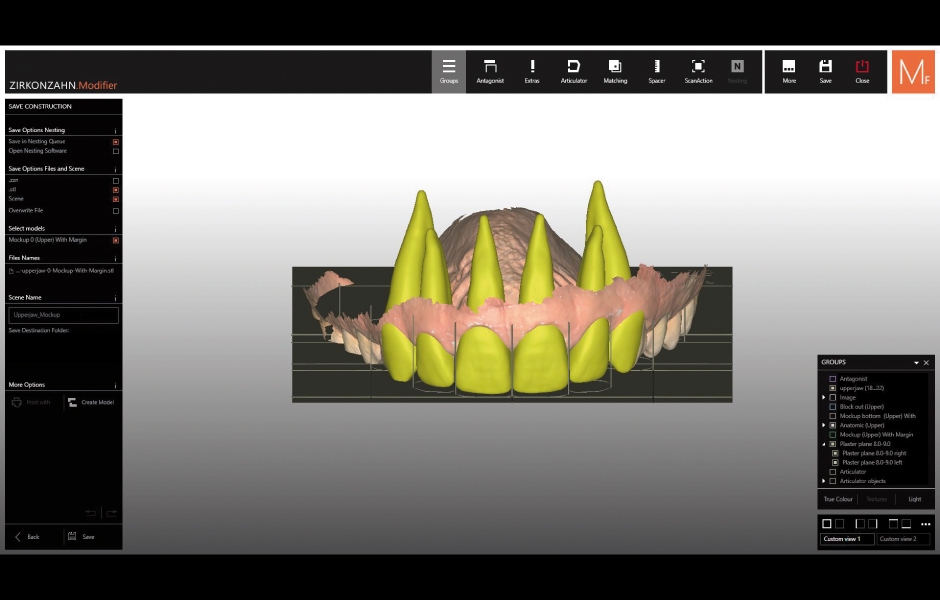 Obr. 8a, b: Setup byl vytvořen pomocí 2D fotografií pacienta s ohledem na optimální estetické parametry – konečný návrh mock-upu.