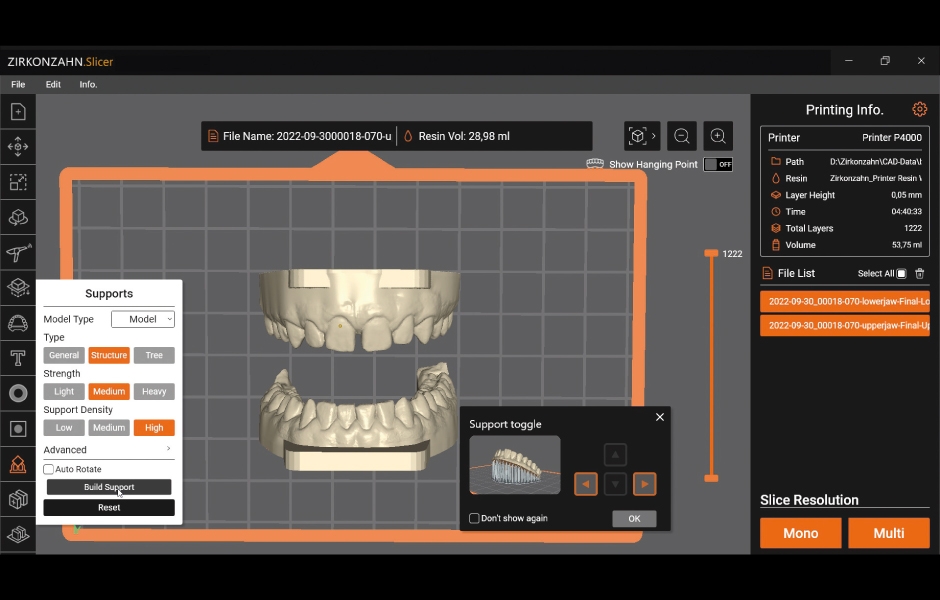 Obr. 9: Import modelu do programu Zirkonzahn.Slicer. Software je již vybaven předkonfigurovaným nastavením pro tisk modelů z materiálu Printer Resin Waterbased Beige.