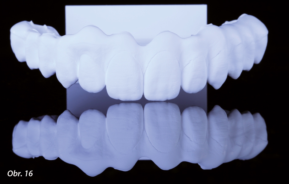 Prettau 2 Dispersive je inovativní zirkon s továrním zbarvením napodobujícím přirozené odstíny zubu od dentinu po sklovinu.