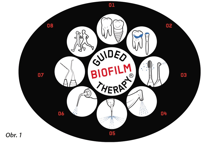 Guided Biofi lm Therapy protocol