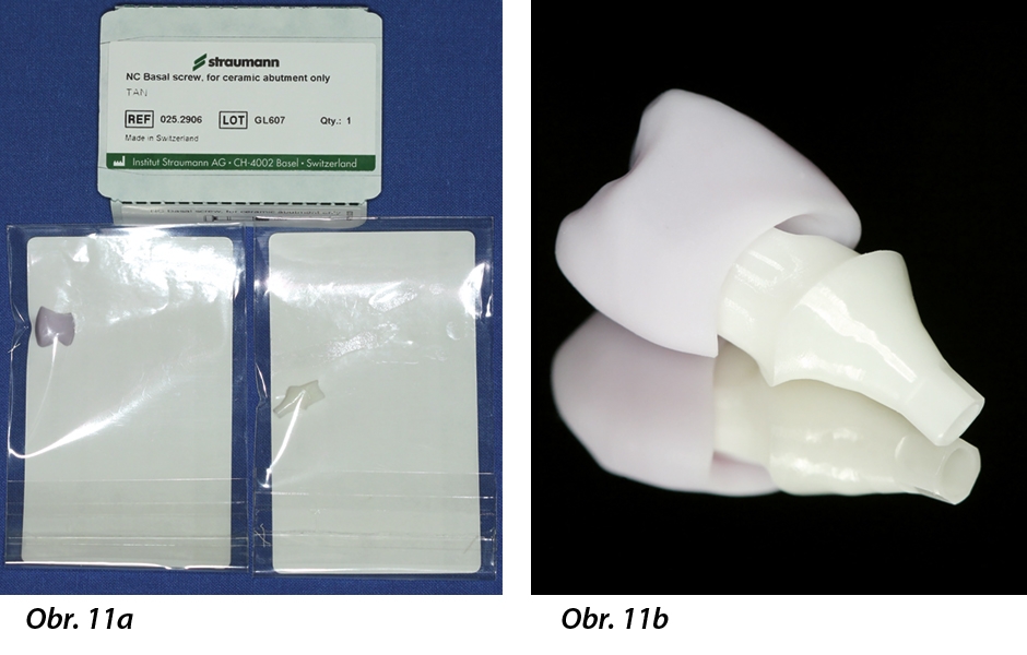 Obr. 11a: Dodávka: balení s upevňovacím šroubkem jasně ukazuje, že je vhodné pouze pro abutmenty z oxidu zirkoničitého. Obr. 11b: Další dvě balení obsahují jednodílný abutment z oxidu zirkoničitého a korunku z lithium disilikátové keramiky.
