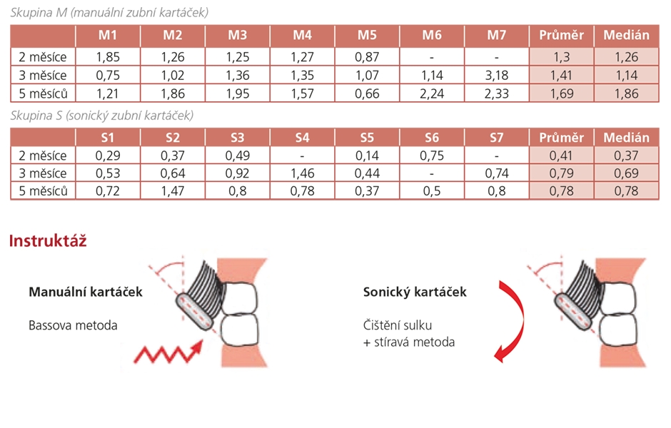 Vliv používání sonického zubního kartáčku na motivaci pacientů k ústní hygieně