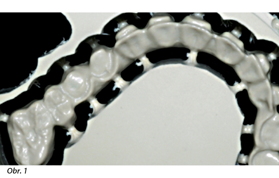 Konstrukce z materiálu Juvora Dental Disc vyrobená CAD/CAM procesem