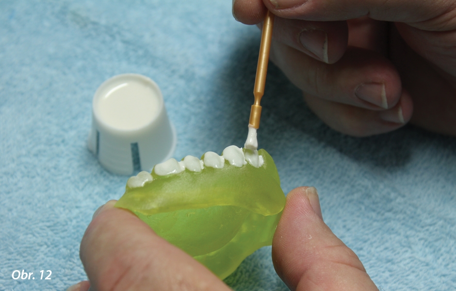 Pomocí jednorázového štětečku se potře povrch zubů
