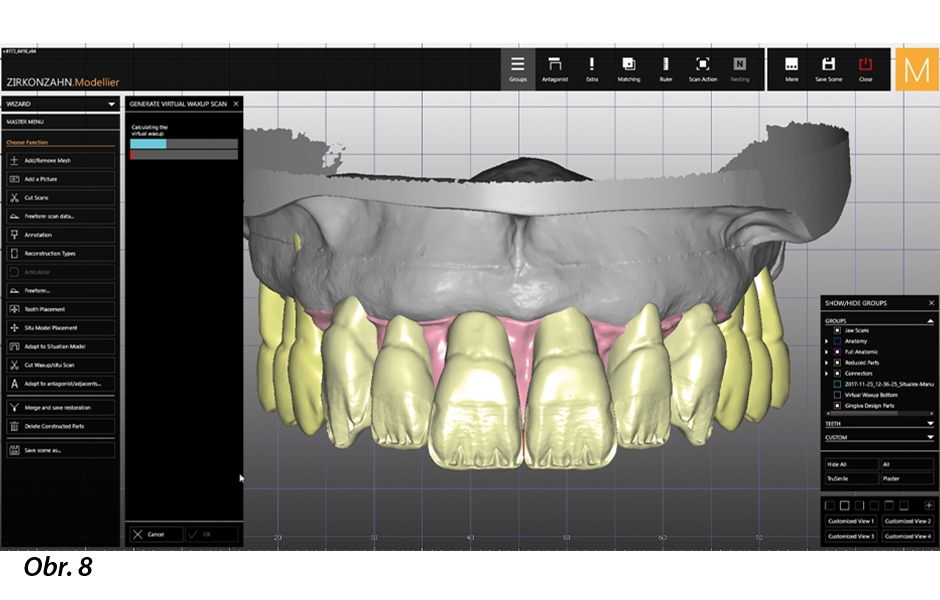 Zdolávání hory jménem dentální technologie