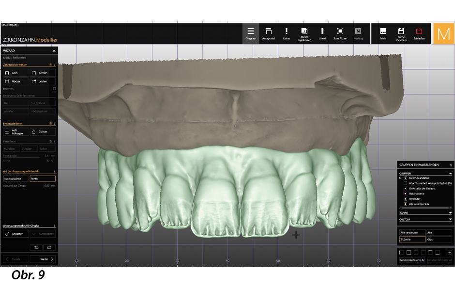 Zdolávání hory jménem dentální technologie