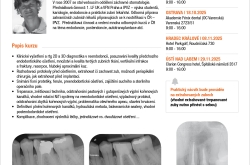 Jak na reendodoncii jednoduše a prakticky