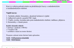 Techniky plnění a základy post-endodontického ošetření Techniky plnění a základy post-endodontického ošetření