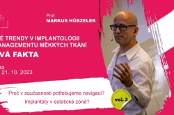 Nové trendy v implantologii a managementu měkkých tkání Nové trendy v implantologii a managementu měkkých tkání