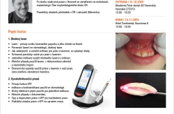 Diodový laser vs. vysokofrekvenční proud