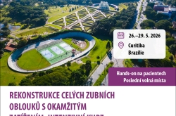 Rekonstrukce celých zubních oblouků s okamžitým zatížením: intenzivní kurz techniky NeoArch 