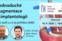 Základy jednoduchých augmentací v implantologii. Jak začít a co je potřeba vědět