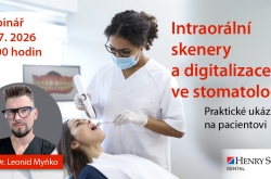 Intraorální skenery a digitalizace ve stomatologii. Praktické ukázky na pacientovi