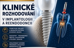 Klinické rozhodování v implantologii a reendodoncii