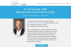 Implants in the esthetic zone