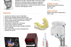 All on X - Navigovaná implantologie prakticky