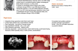 Augmentační techniky