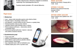 Diodový laser vs. vysokofrekvenční proud