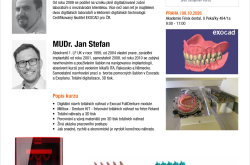 EXOCAD Totální náhrady - frézovat nebo tisknout?