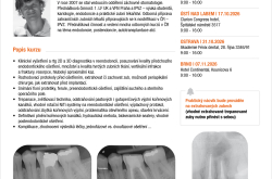Jak na reendodoncii jednoduše a prakticky