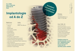 Implantologie od A do Z