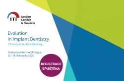 Evolution in Implant Dentistry