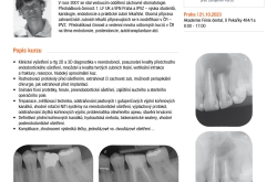 Jak na reendodoncii jednoduše a prakticky