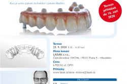 Zirkonová protetická práce nesená implantáty v horní čelisti Zirkonová protetická práce nesená implantáty v horní čelisti