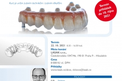 Zirkonová protetická práce nesená implantáty v horní čelisti Zirkonová protetická práce nesená implantáty v horní čelisti