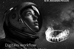 Od vizualizace k výsledku: Digitální workflow a navigovaná implantace