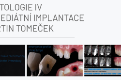 Implantologie IV - Kurz Imediátní implantace