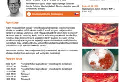 Postupy augmentování v implantologii