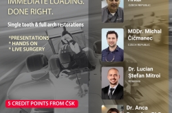 SKY implant systems Bredent – náhrada jednoho zubu, kompletní rekonstrukce – Full-Arch SKY fast & fixed, pasivní a aktivní navigace