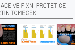 Preparace ve fixní protetice 