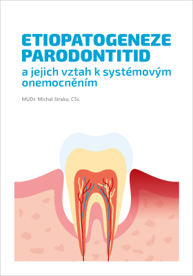 Etiopatogeneze parodontitid a jejich vztah k systémovým onemocněním