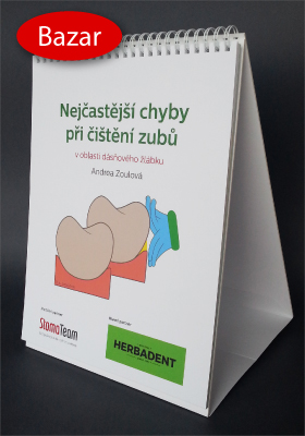 Nejčastější chyby při čištění zubů v oblasti dásňového žlábku